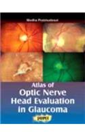 Atlas of Optic Nerve Head Evaluation in Glocauma
