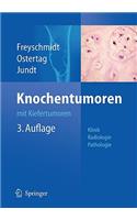 Knochentumoren Mit Kiefertumoren