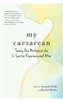 My Caesarean