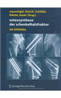 Osteosynthese der schenkelhalsfraktur