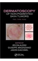 Dermatoscopy of Non-Pigmented Skin Tumors