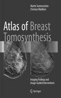 Atlas of Breast Tomosynthesis