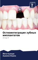 &#1054;&#1089;&#1090;&#1077;&#1086;&#1080;&#1085;&#1090;&#1077;&#1075;&#1088;&#1072;&#1094;&#1080;&#1103; &#1079;&#1091;&#1073;&#1085;&#1099;&#1093; &#1080;&#1084;&#1087;&#1083;&#1072;&#1085;&#1090;&#1072;&#1090;&#1086;&#1074;