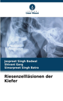 Riesenzellläsionen der Kiefer