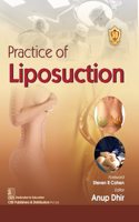 Practice of Liposuction (PB-2024)