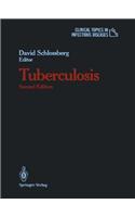 Tuberculosis