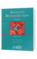 Advanced Reconstruction: Knee