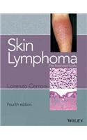 Skin Lymphoma