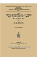 Arten Der Schlaganfälle Des Gehirns Und Ihre Entstehung
