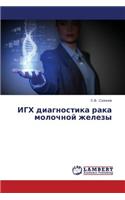 IGKh diagnostika raka molochnoy zhelezy