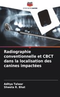Radiographie conventionnelle et CBCT dans la localisation des canines impactées