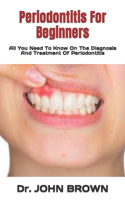 Periodontitis For Beginners