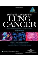 Principles and Practice of Lung Cancer