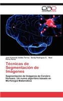 Tecnicas de Segmentacion de Imagenes