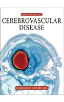 Principles of Cerebrovascular Disease