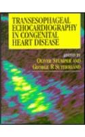 Transesophageal Echocardiography in Congenital Heart Disease