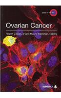 Ovarian Cancer