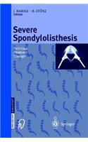 Severe Spondylolisthesis