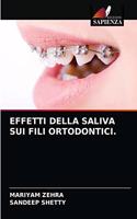 Effetti Della Saliva Sui Fili Ortodontici.