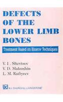 Defects Of The Lower Limb Bones