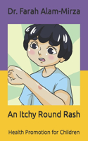Itchy Round Rash