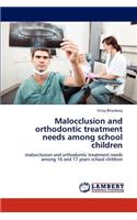 Malocclusion and orthodontic treatment needs among school children