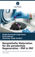Beispielhafte Materialien für die parodontale Regeneration - PRP & PRF