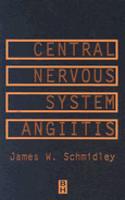 Central Nervous System Angiitis