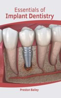 Essentials of Implant Dentistry