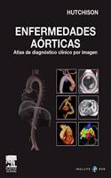 Enfermedades aorticas + DVD-ROM (Spanish Edition)