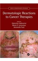 Dermatologic Reactions to Cancer Therapies