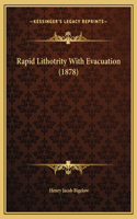 Rapid Lithotrity With Evacuation (1878)