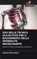 USO Della Tecnica Hla-B27pcr Per Il Rilevamento Della Spondilite Anchilosante