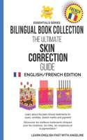 The Ultimate Skin Correction Guide: English/French Edition(Learn English Fast Essentials Series: English French Edition)
