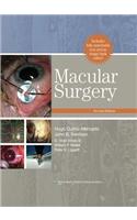 Macular Surgery