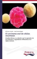 carcinoma oral de células escamosas