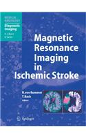 Magnetic Resonance Imaging in Ischemic Stroke