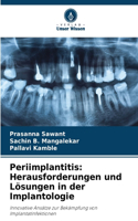 Periimplantitis