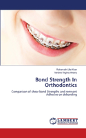 Bond Strength In Orthodontics