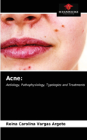 Acne