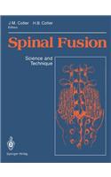 Spinal Fusion: Science and Technique