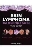 Skin Lymphoma