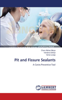 Pit and Fissure Sealants