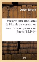 Contribution À l'Étude Des Fractures Intra-Articulaires de l'Épaule Par Contraction Musculaire