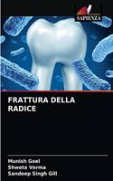 Frattura Della Radice