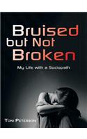 Bruised but Not Broken: My Life with a Sociopath