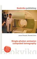 Single-Photon Emission Computed Tomography