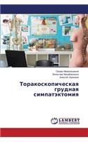 Torakoskopicheskaya grudnaya simpatektomiya