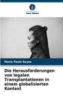 Herausforderungen von legalen Transplantationen in einem globalisierten Kontext