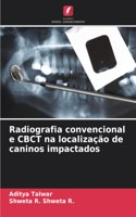 Radiografia convencional e CBCT na localização de caninos impactados